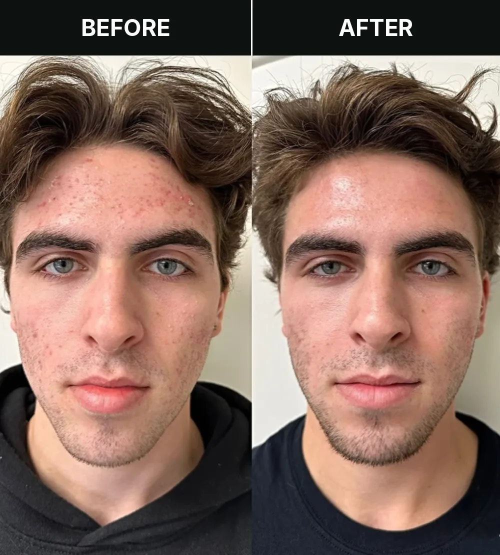 Customer 2, before and after treatment