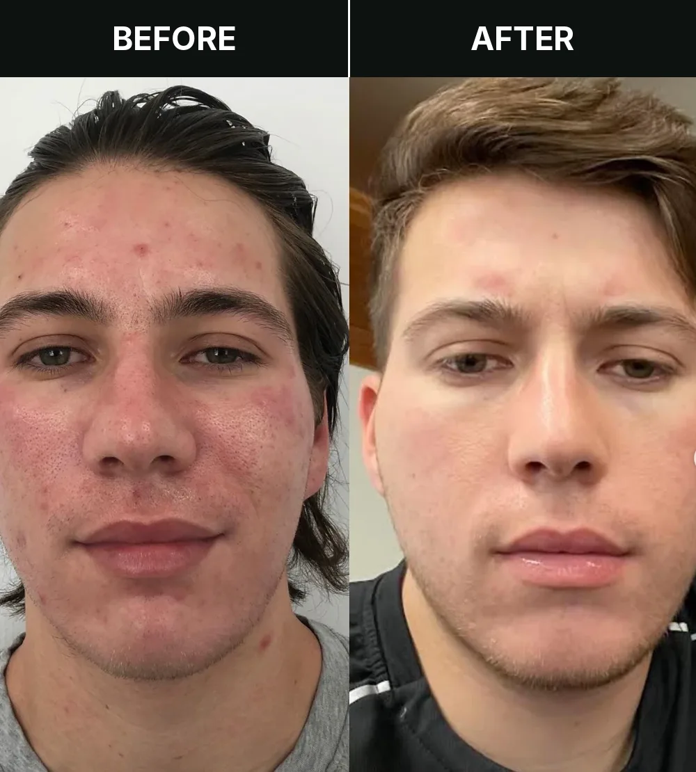 Customer 3, before and after treatment