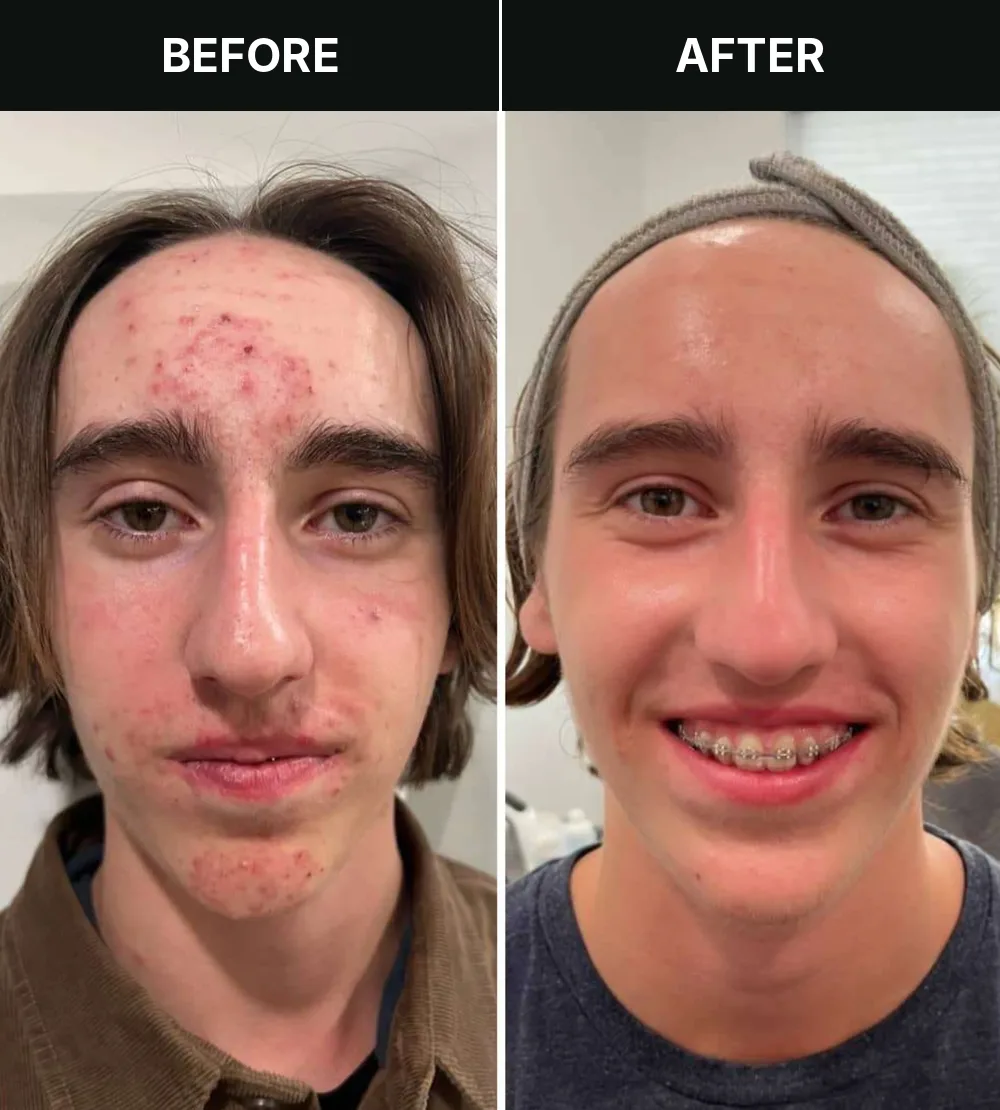 Customer 5, before and after treatment