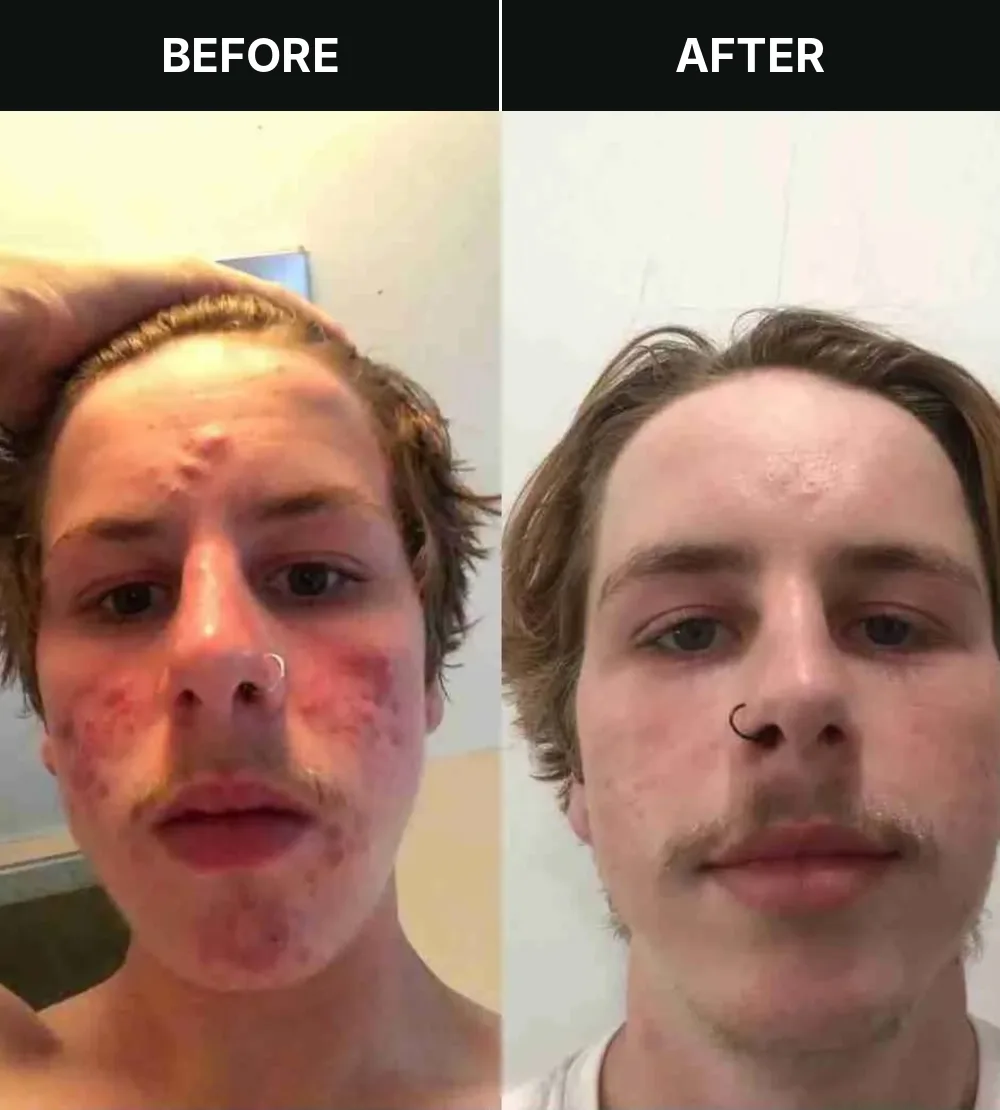 Customer 6, before and after treatment