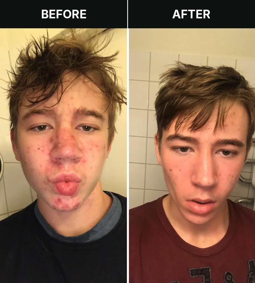 Customer 7, before and after treatment